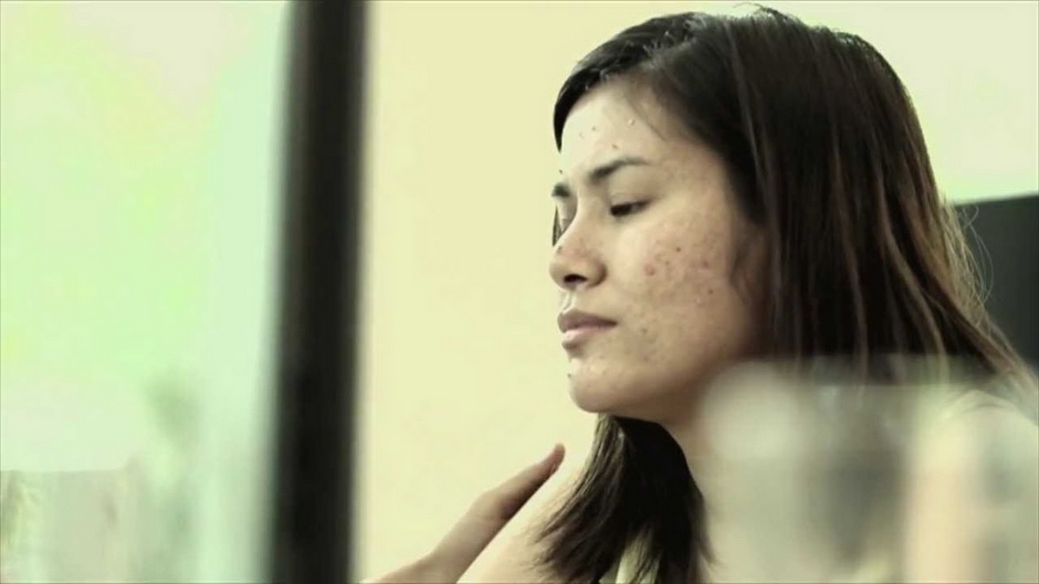 Suay Sud Siam 12th of Mar 2014 How to improve Acne face to become beauty looks.