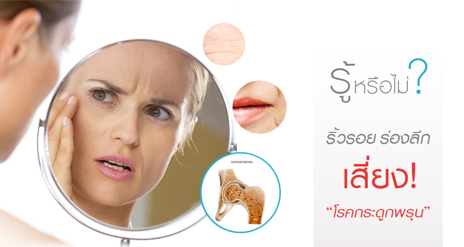 รู้หรือไม่?  ริ้วรอย ร่องลึกบนผิว เสี่ยง! “โรคกระดูกพรุน”
