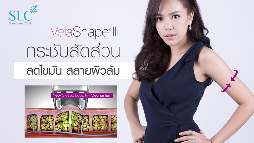 Velashape III | ไอซ์ ณพัชรินทร์