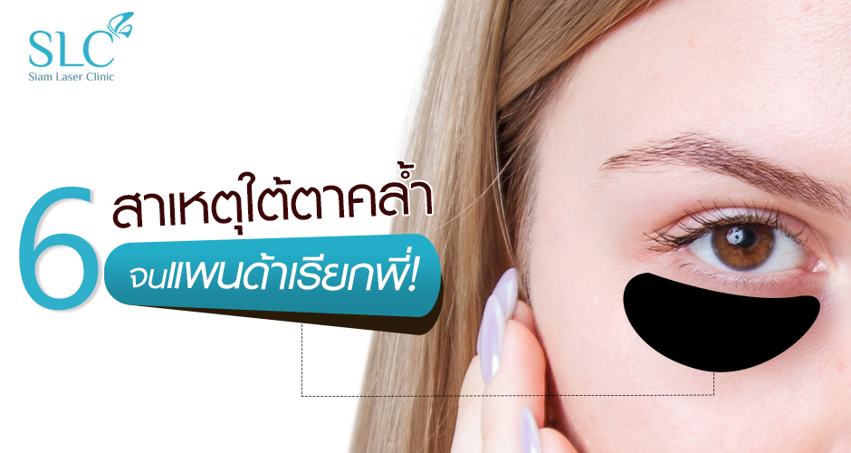 6 สาเหตุใต้ตาคล้ำจนแพนด้าเรียกพี่!