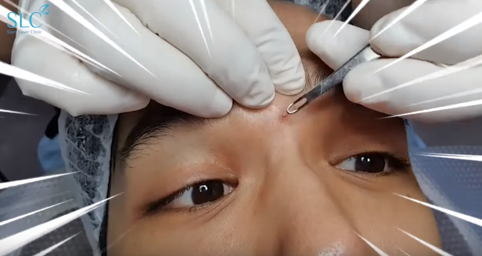 ตามไปดู! เคล็ดลับหน้าใส หน้าเรียว แบบเฟี้ยวฟ้าวของหนุ่ม