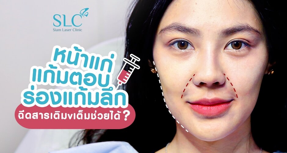 หน้าแก่ แก้มตอบ ร่องแก้มลึก ฉีดสารเติมเต็มช่วยได้?