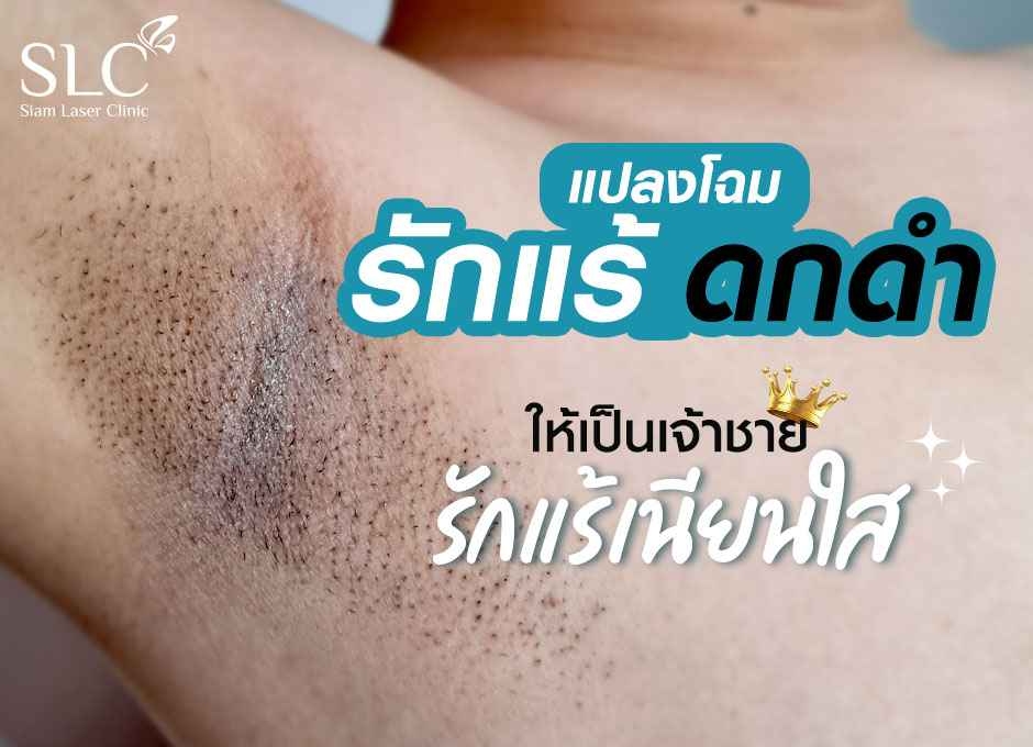 แปลงโฉม รักแร้รกดำ! ให้เป็นเจ้าชายรักแร้เนียนใส