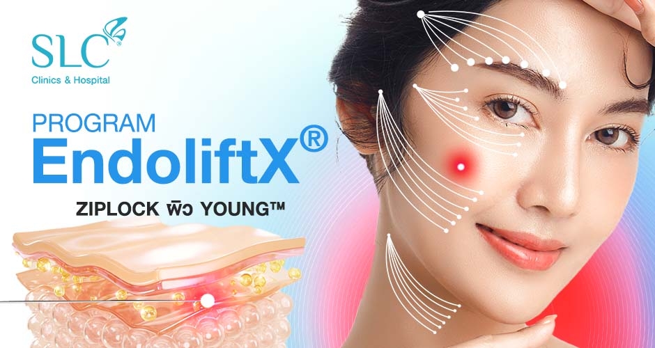 โปรแกรม EndoliftX® เลเซอร์ยกกระชับด้วยแสง ล็อคผิว Young™
