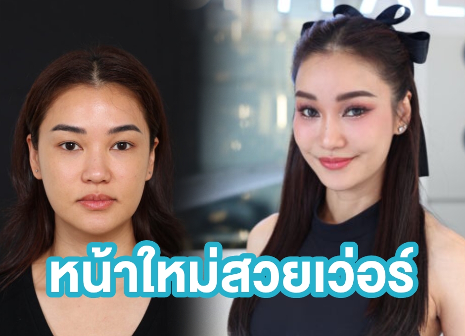 ชมพู่ ก่อนบ่าย เปิดใจทำโปรแกรมยกกระชับอัลตร้าซาวด์ SLC ครั้งแรก เห็นผลจริงหรือแค่กระแส?