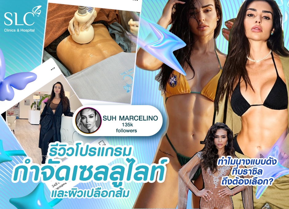 รีวิวโปรแกรมกำจัดเซลลูไลท์ และผิวเปลือกส้ม ทำไมนางแบบดังที่บราซิลถึงต้องเลือก?